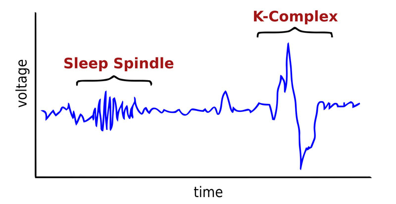 A fictional EEG showing a sleep spindle and K-complex in stage 2 sleep.