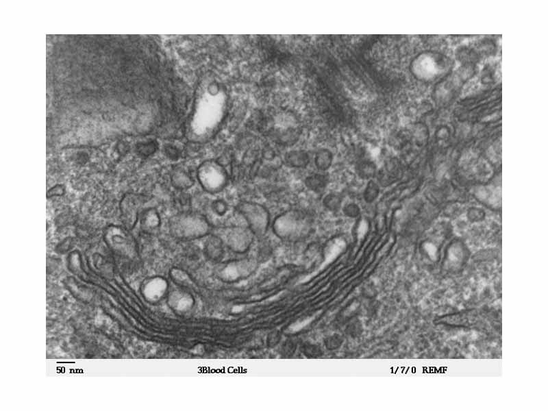 Micrograph of Golgi apparatus, visible as a stack of semicircular black rings near the bottom. Numerous circular vesicles can be seen in proximity to the organelle