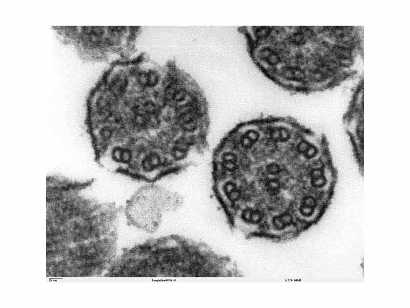 Cross-section of two motile cilia, showing the 9+2 structure