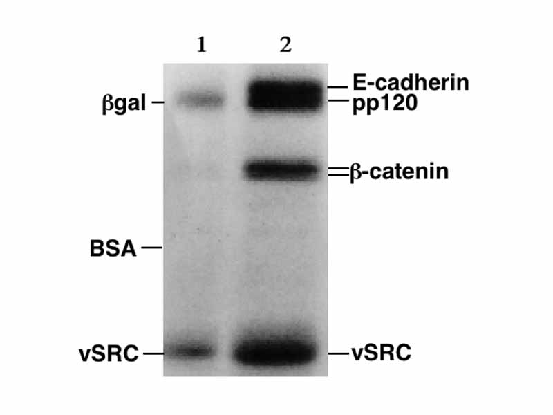 SDS-PAGE autoradiography. The indicated proteins are present in different concentrations in the two samples.