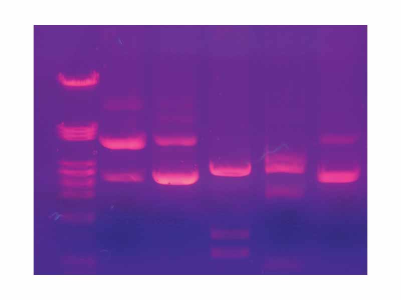 A pattern of DNA-bands under UV light