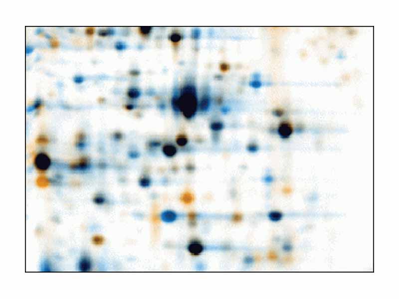 Warping: Images of two 2D electrophoresis gels, overlaid and warped with Delta2D. First image is colored in orange, second one colored in blue. Corresponding spots overlap after warping. Common spots are colored black, orange spots are only present (or much stronger) on the first image, blue spots are only present (or much stronger) on the second image.