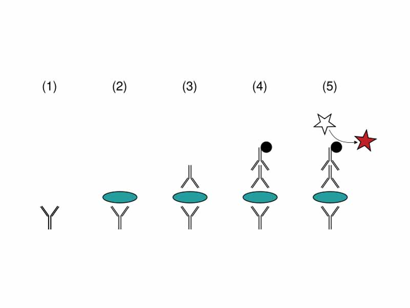 A sandwich ELISA. (1) Plate is coated with a capture antibody; (2) sample is added, and any antigen present binds to capture antibody; (3) detecting antibody is added, and binds to antigen; (4) enzyme-linked secondary antibody is added, and binds to detecting antibody; (5) substrate is added, and is converted by enzyme to detectable form.