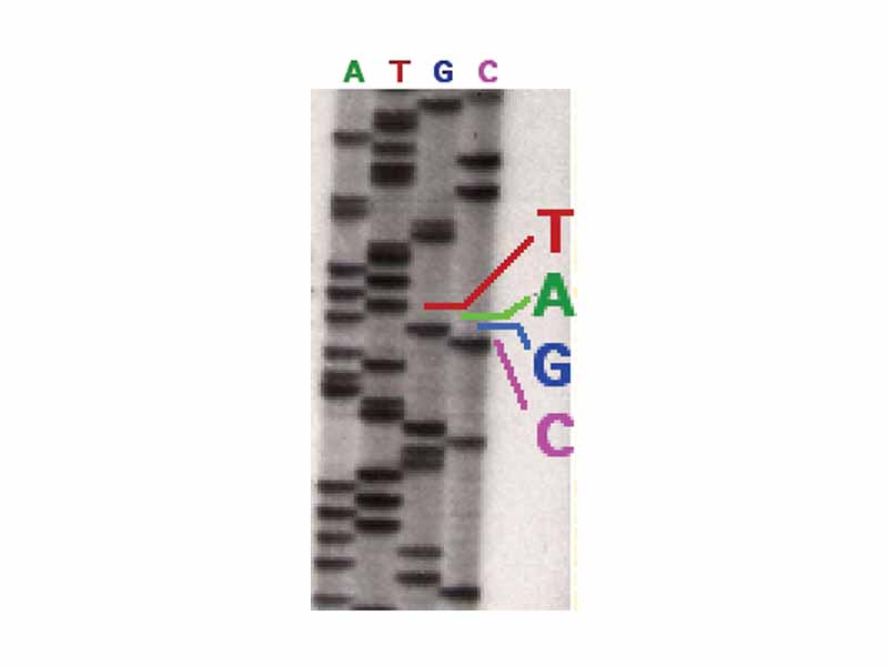 Part of a radioactively labelled sequencing gel