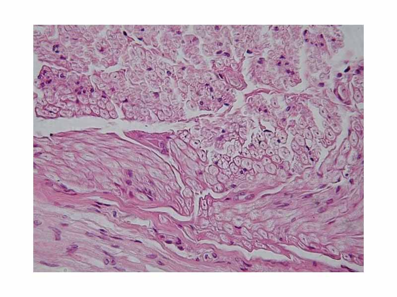 Peripheral nerve cross section