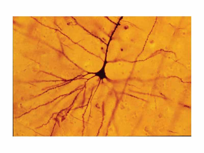 A human neocortical pyramidal neuron stained via Golgi technique. Notice the apical dendrite extending vertically above the soma and the numerous basal dendrites radiating laterally from the base of the cell body.