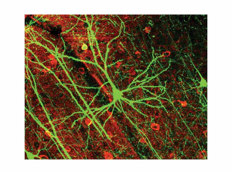 mage of pyramidal neurons in mouse cerebral cortex expressing green fluorescent protein. The red staining indicates GABAergic interneurons.