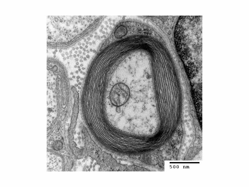 Transmission electron micrograph of a myelinated neuron. Generated at the Electron Microscopy Facility at Trinity College, Hartford, CT