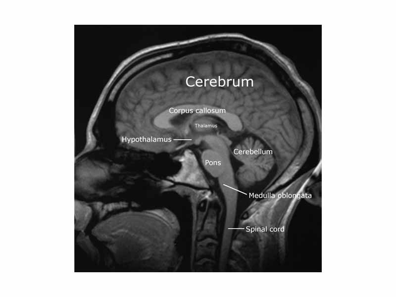 Sagittal slice from a MRI scan of a human brain. See an animated sequence of slices.