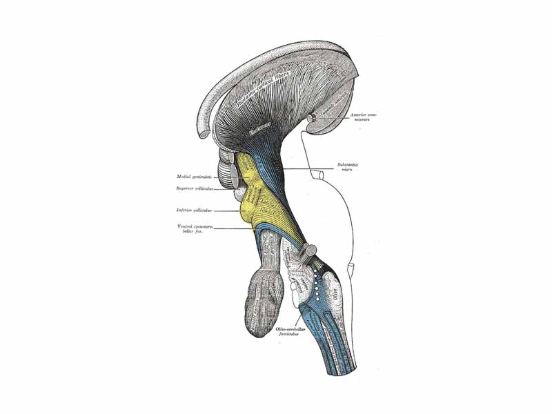 Deep dissection of brain-stem. Lateral view. (Inferior colliculus is yellow, and is labeled at left.