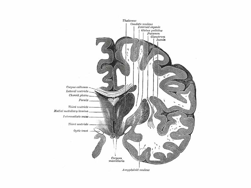 Coronal section of brain through intermediate mass of third ventricle.