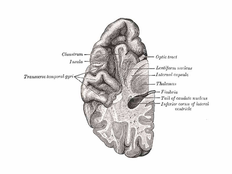 Section of brain showing upper surface of temporal lobe.