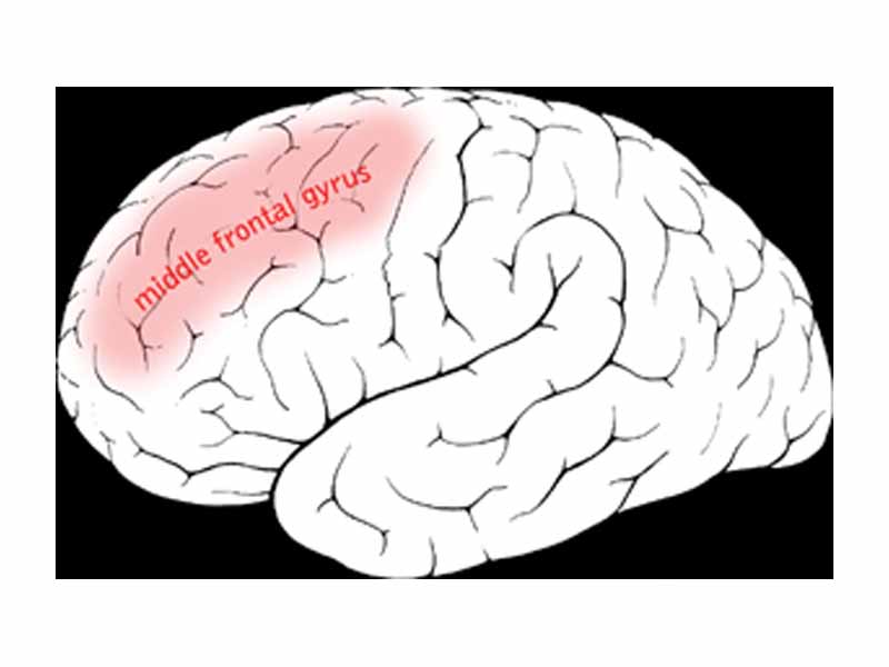 Middle frontal gyrus of the human brain.