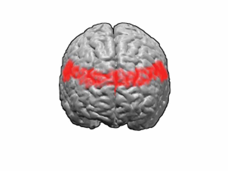 Brodmann area 9. BA9 is in the dorsal-lateral part of the frontal lobe.