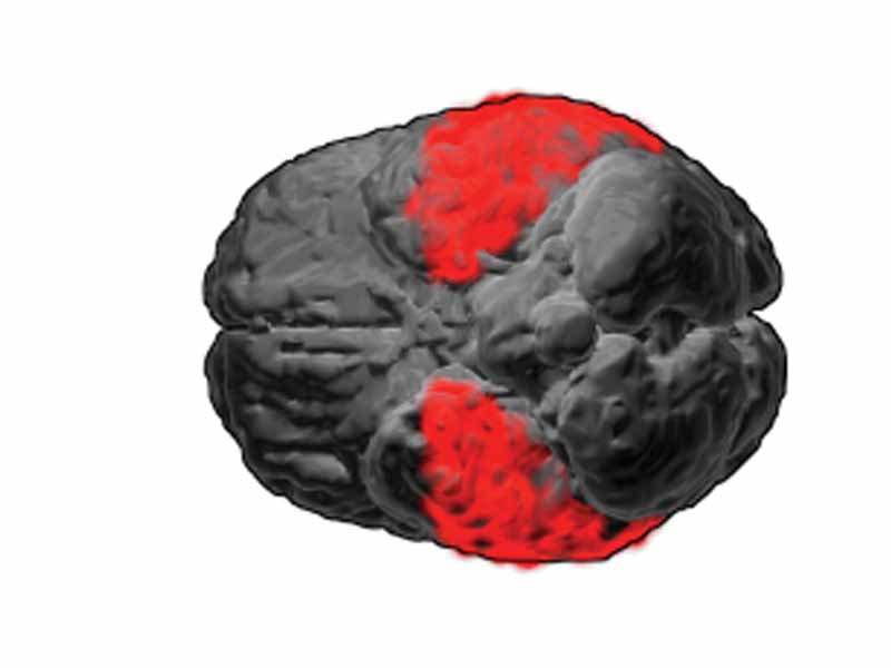 Brodmann area 20.  BA20 is in the ventral temporal lobe.