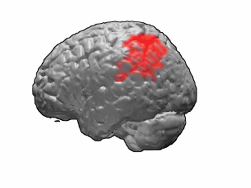 Brodmann area 40, or BA40, is part of the parietal cortex in the human brain. 