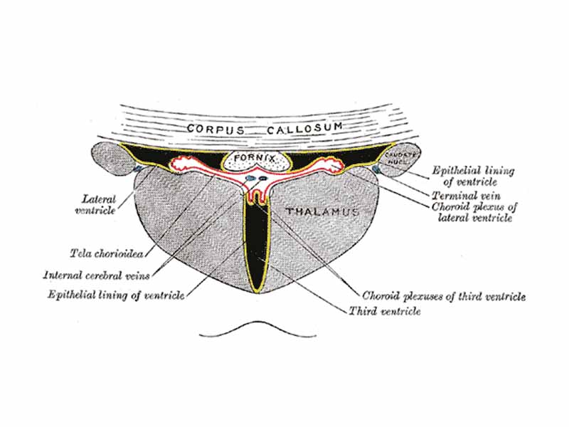 Coronal section of lateral and third ventricles.