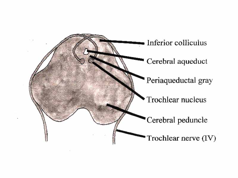 Transverse Section of the Brainstem at the level of the Inferior Colliculus