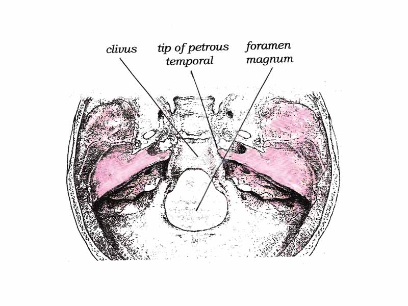 The Clivus