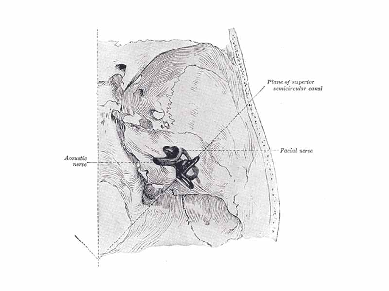 Position of the right bony labyrinth of the ear in the skull, viewed from above.