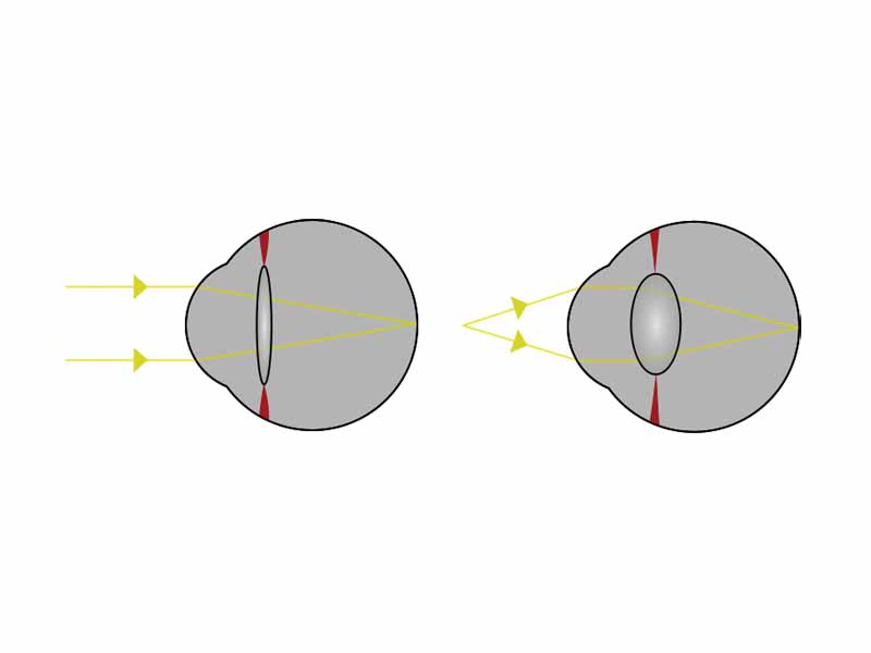 Light from a single point of a distant object and light from a single point of a near object being brought to a focus