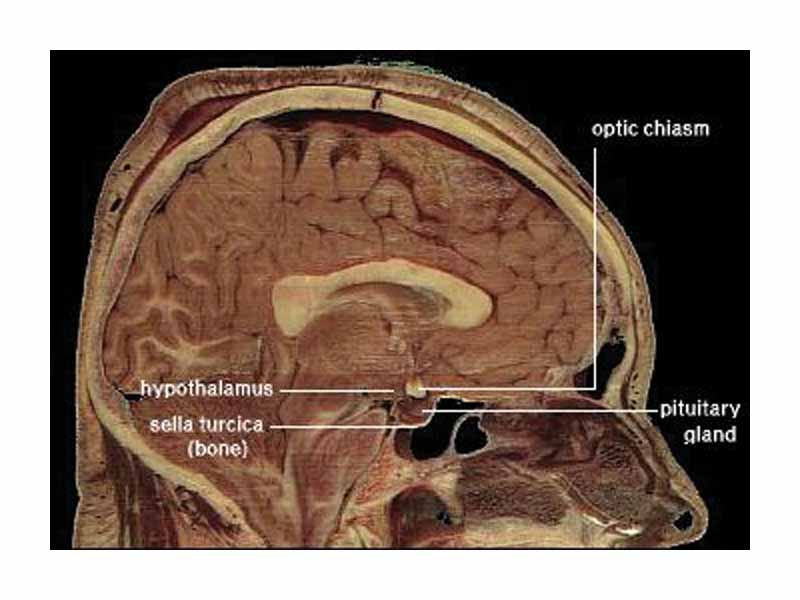 Hypothalamus