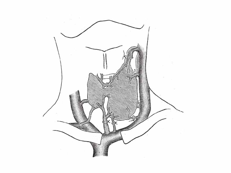 Diagram showing common arrangement of thyroid veins.