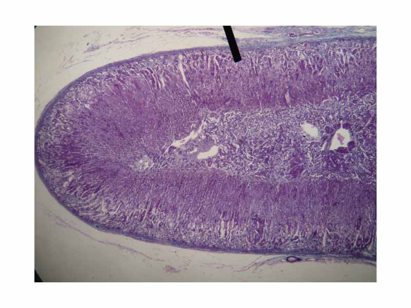 Cortical part of the adrenal gland (on the pointer).