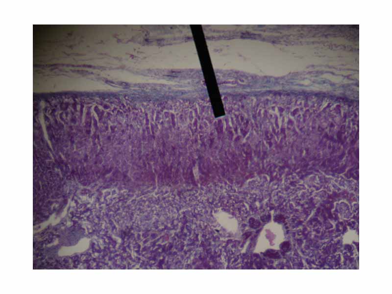 Adrenal gland (zona glomerulosa layer).