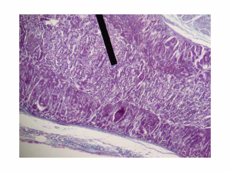 Medullary part of the adrenal gland (on the pointer).