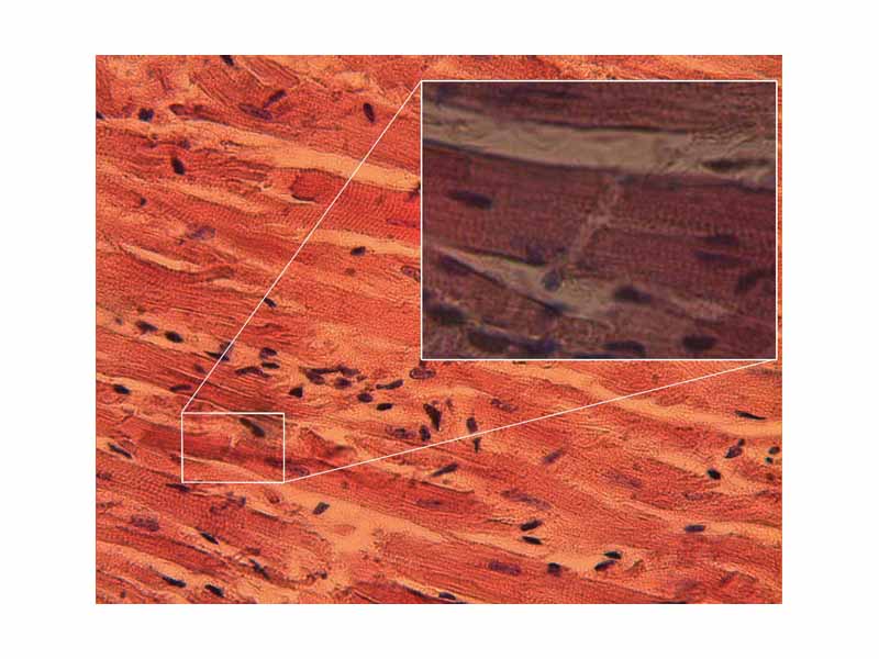 Cardiac muscle