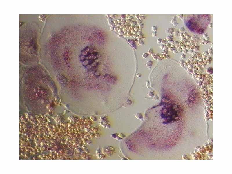 Tartrate resistant acid phosphatase positive osteoclast in cell culture