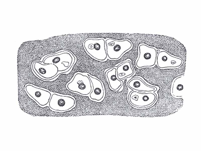 Human cartilage cells from the cricoid cartilage.