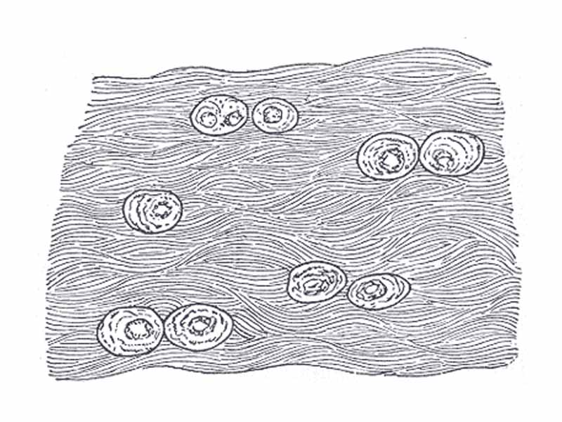 White fibrocartilage from an intervertebral fibrocartilage.