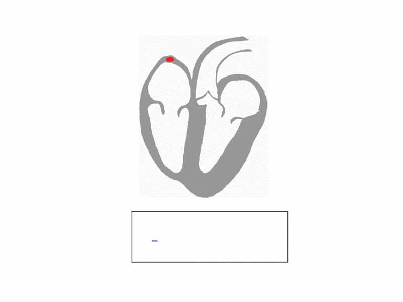 Animation - Principle of ECG formation