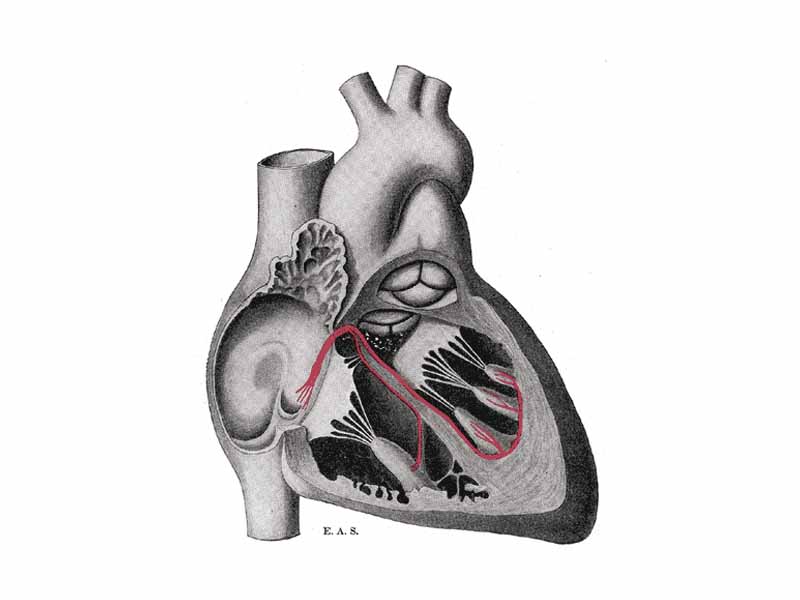 Schematic representation of the atrioventricular bundle of His.