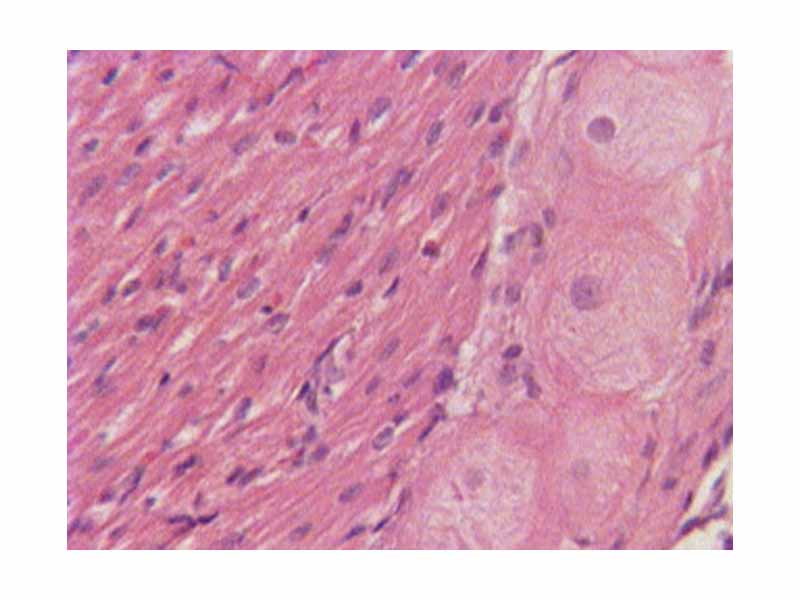 Purkinje fibers in H&E stained cardiac muscle.