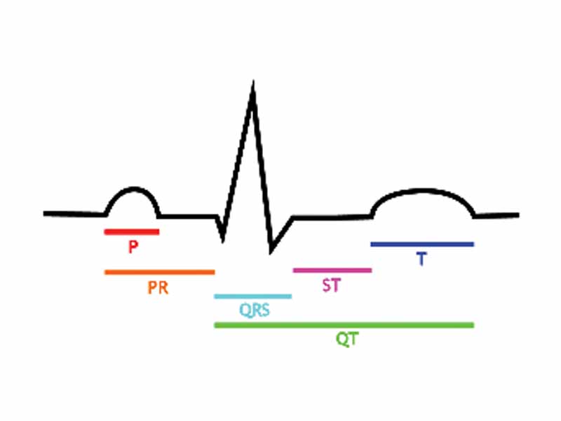 The EKG complex. P=P wave, PR=PR interval, QRS=QRS complex, QT=QT interval, ST=ST segment, T=T wave