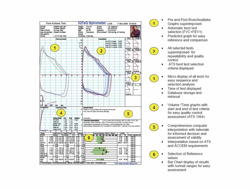 An example of a modern spirometer printout, http://www.iqteq.com