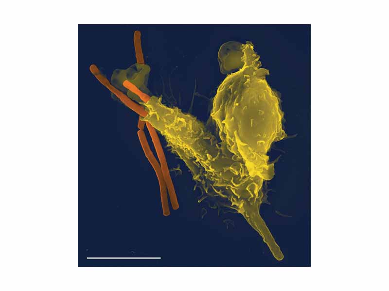 A scanning electron microscope image of a single neutrophil (yellow), engulfing anthrax bacteria (orange).