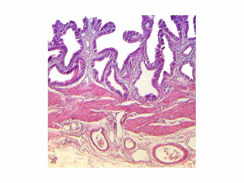 Stained section of a gall bladder showing the highly convoluted mucosal folds