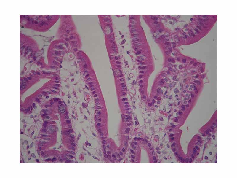 Duodenum with brush border (microvilli)