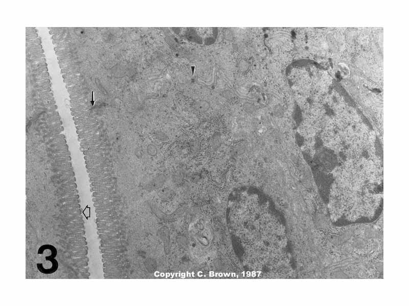 Microvilli show electron dense plaques (open arrow) at their apices. These plaques may be the anchoring point for the microfilaments which run up through the core of the microvilli. While an extensive glycocalyx is present on the microvilli of many mammals, the microvilli observed in this study do not demonstrate any visible glycocalyx. The junctional complex (arrow) at the apices of the epithelial cells is supplemented by numerous spot desmosomes (arrow head) on the lateral surfaces of the cells. Magnification: 14,000 x