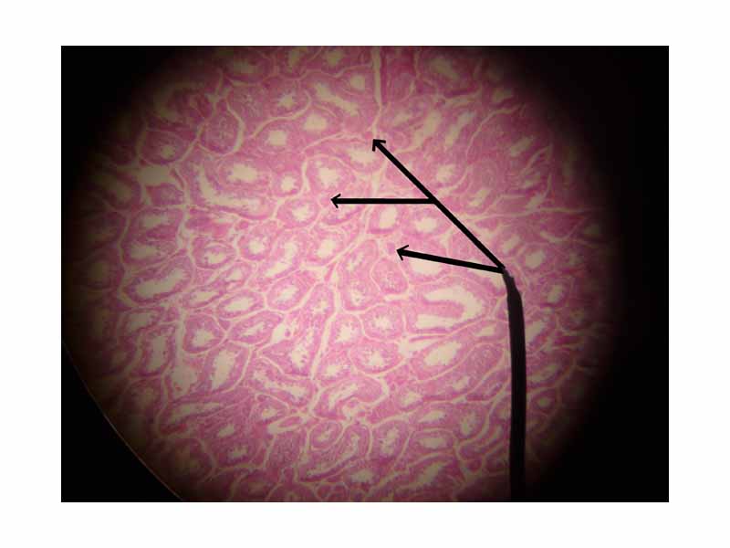 Cross-section of seminiferous tubules. Arrows indicate location of Leydig cells.