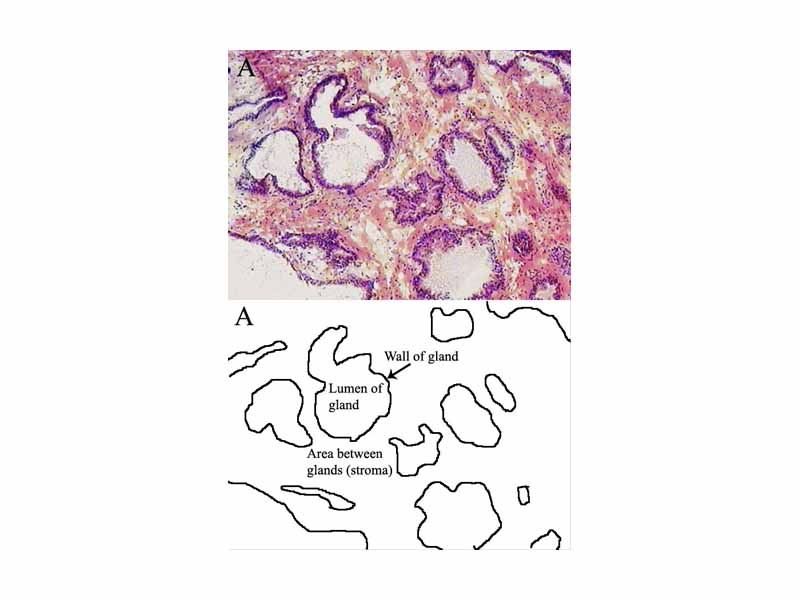 Prostate histology