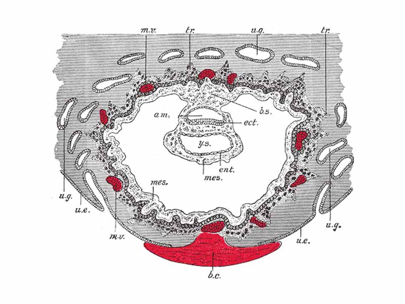 Section through ovum imbedded in the uterine decidua. Semidiagrammatic.  -    -  am. Amniotic cavity.  -  b.c. Blood-clot.  -  b.s. Body-stalk.  -  ect. Embryonic ectoderm.  -  ent. Entoderm.  -  mes. Mesoderm.  -  m.v. Maternal vessels.  -  tr. Trophoblast.  -  u.e. Uterine epithelium.  -  u.g. Uterine glands.  -  y.s. Yolk-sac.