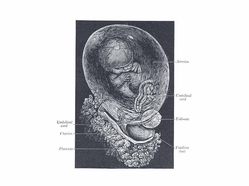 Fetus of about eight weeks, enclosed in the amnion. Magnified a little over two diameters.