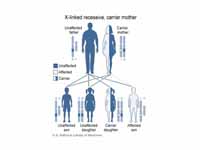 X-linked Recessive inheritance