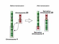 Chromosomal translocation of the 4th ...