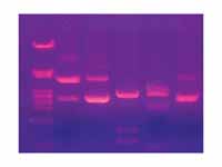 A pattern of DNA-bands under UV light